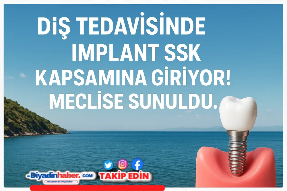 Diş tedavisinde İmplant SSK kapsamına giriyor! Meclise sunuldu…